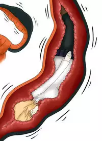 セルの丸呑み吸収